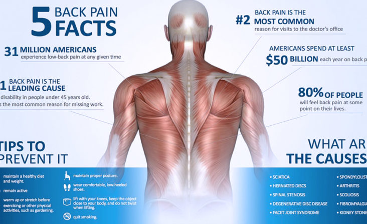 Depression is by far the most common emotion associated with chronic back pain. The type of depression that often accompanies chronic pain is referred to as major depression or clinical depression.