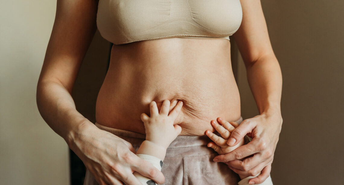 A Mommy Makeover in Tijuana, Mexico, typically costs between $7,000 and $15,500, depending on the specific procedures included.